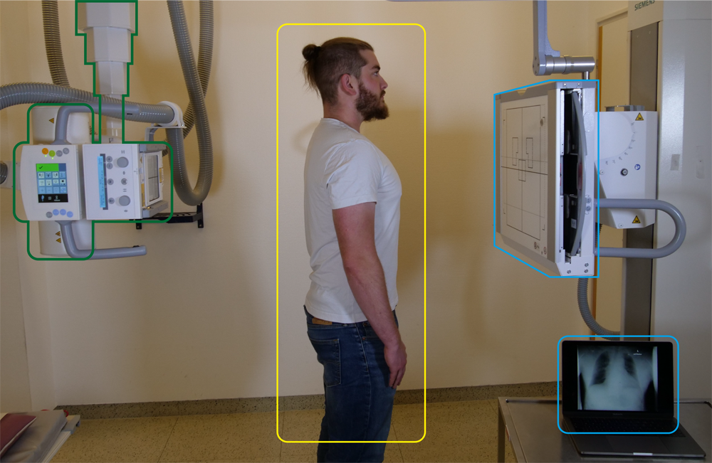 Röntgenuntersuchung